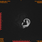 2026-04-15/Brain/AAHead Scout/0127-IM145.png