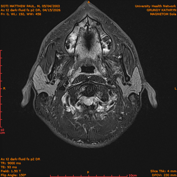 2026-04-15/Brain/Ax t2 dark-fluid fs p2 DR/0001-IM188.png