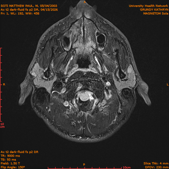 2026-04-15/Brain/Ax t2 dark-fluid fs p2 DR/0002-IM189.png