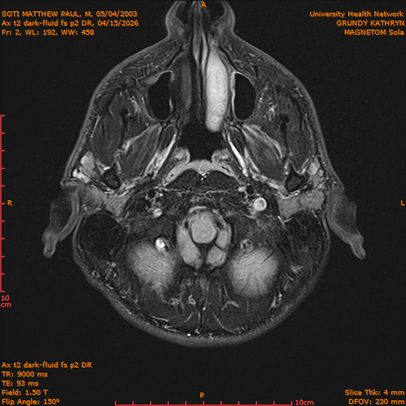 2026-04-15/Brain/Ax t2 dark-fluid fs p2 DR/0003-IM190.png