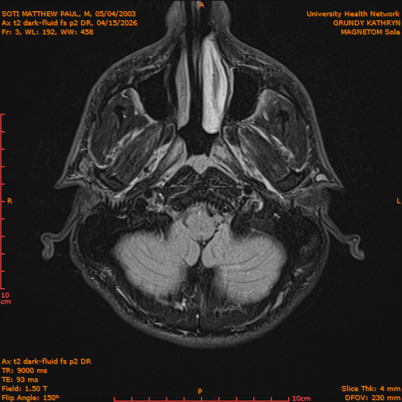 2026-04-15/Brain/Ax t2 dark-fluid fs p2 DR/0004-IM191.png