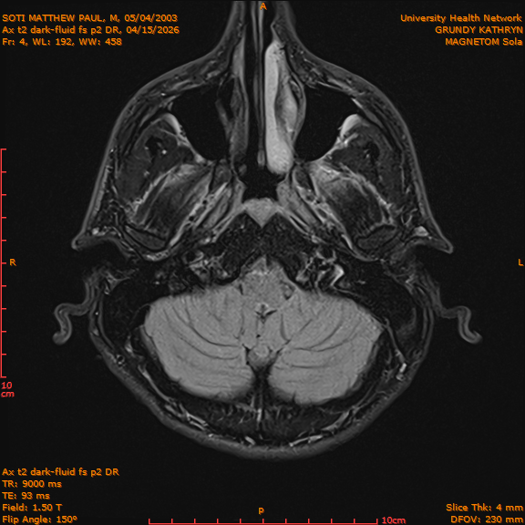 2026-04-15/Brain/Ax t2 dark-fluid fs p2 DR/0005-IM192.png