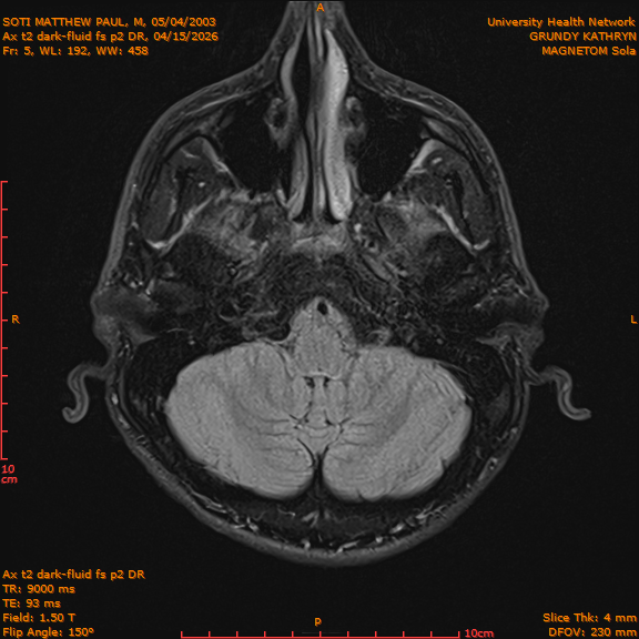 2026-04-15/Brain/Ax t2 dark-fluid fs p2 DR/0006-IM193.png
