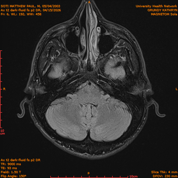 2026-04-15/Brain/Ax t2 dark-fluid fs p2 DR/0007-IM194.png