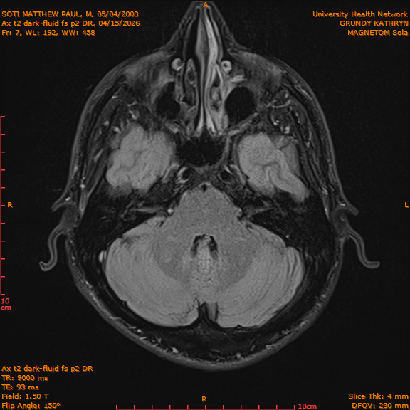 2026-04-15/Brain/Ax t2 dark-fluid fs p2 DR/0008-IM195.png