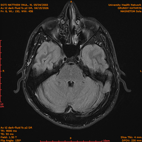 2026-04-15/Brain/Ax t2 dark-fluid fs p2 DR/0009-IM196.png