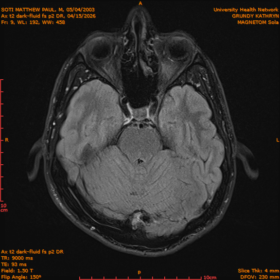 2026-04-15/Brain/Ax t2 dark-fluid fs p2 DR/0010-IM197.png