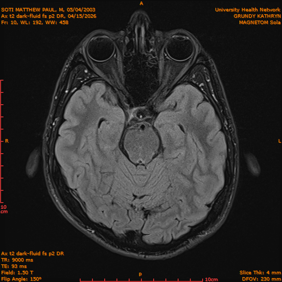 2026-04-15/Brain/Ax t2 dark-fluid fs p2 DR/0011-IM198.png