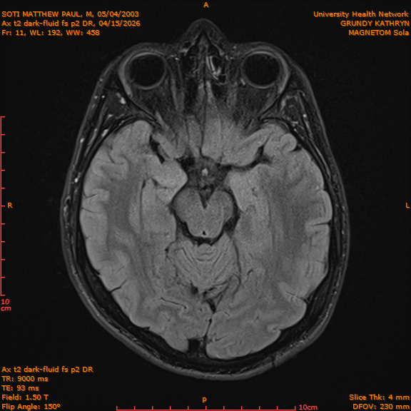 2026-04-15/Brain/Ax t2 dark-fluid fs p2 DR/0012-IM199.png