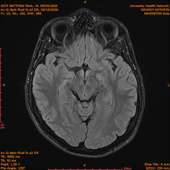 2026-04-15/Brain/Ax t2 dark-fluid fs p2 DR/0013-IM200.png