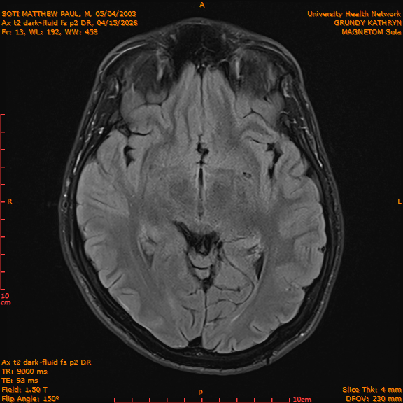 2026-04-15/Brain/Ax t2 dark-fluid fs p2 DR/0014-IM201.png