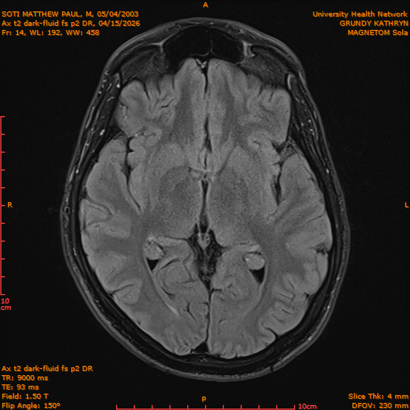 2026-04-15/Brain/Ax t2 dark-fluid fs p2 DR/0015-IM202.png