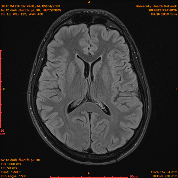 2026-04-15/Brain/Ax t2 dark-fluid fs p2 DR/0017-IM204.png