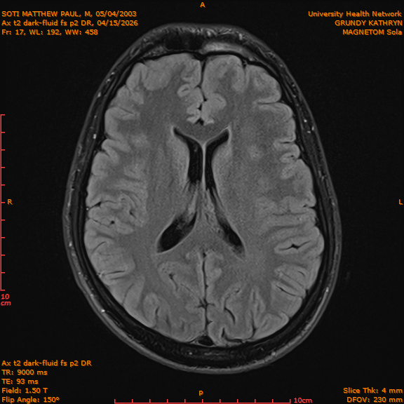 2026-04-15/Brain/Ax t2 dark-fluid fs p2 DR/0018-IM205.png