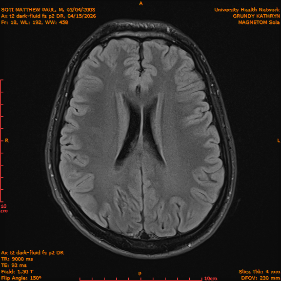 2026-04-15/Brain/Ax t2 dark-fluid fs p2 DR/0019-IM206.png
