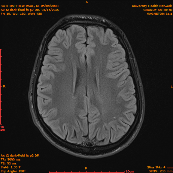 2026-04-15/Brain/Ax t2 dark-fluid fs p2 DR/0020-IM207.png