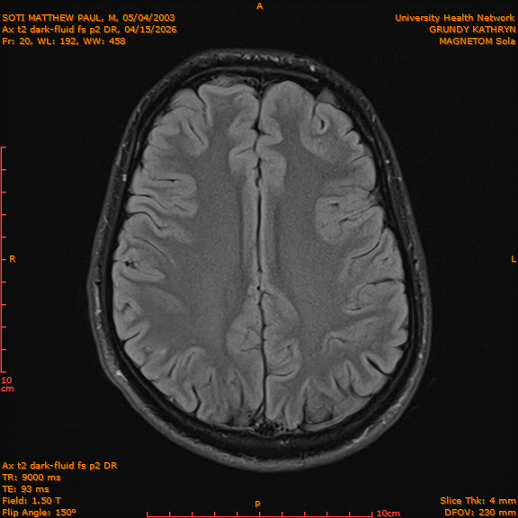 2026-04-15/Brain/Ax t2 dark-fluid fs p2 DR/0021-IM208.png