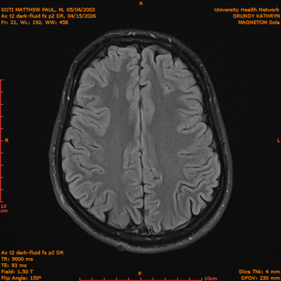 2026-04-15/Brain/Ax t2 dark-fluid fs p2 DR/0022-IM209.png