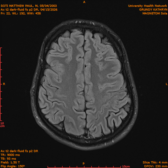 2026-04-15/Brain/Ax t2 dark-fluid fs p2 DR/0023-IM210.png