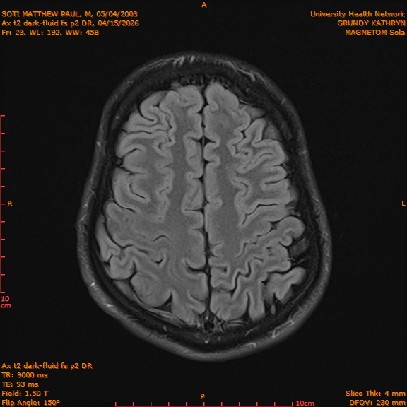 2026-04-15/Brain/Ax t2 dark-fluid fs p2 DR/0024-IM211.png