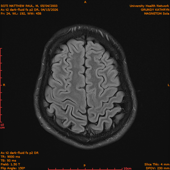 2026-04-15/Brain/Ax t2 dark-fluid fs p2 DR/0025-IM212.png