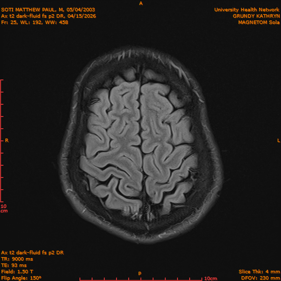 2026-04-15/Brain/Ax t2 dark-fluid fs p2 DR/0026-IM213.png