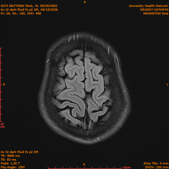 2026-04-15/Brain/Ax t2 dark-fluid fs p2 DR/0027-IM214.png