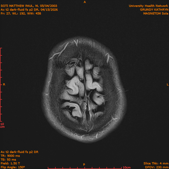 2026-04-15/Brain/Ax t2 dark-fluid fs p2 DR/0028-IM215.png