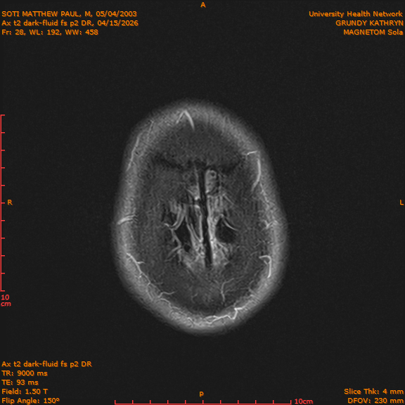 2026-04-15/Brain/Ax t2 dark-fluid fs p2 DR/0029-IM216.png