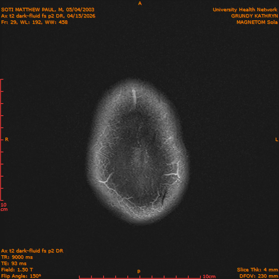 2026-04-15/Brain/Ax t2 dark-fluid fs p2 DR/0030-IM217.png