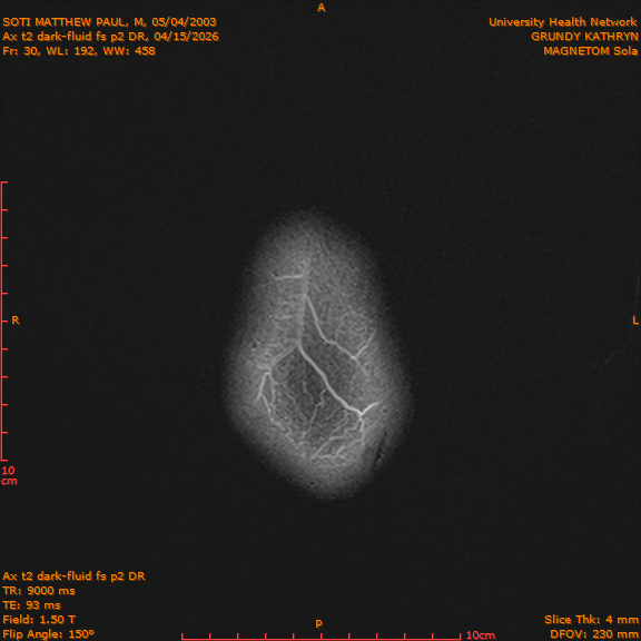 2026-04-15/Brain/Ax t2 dark-fluid fs p2 DR/0031-IM218.png
