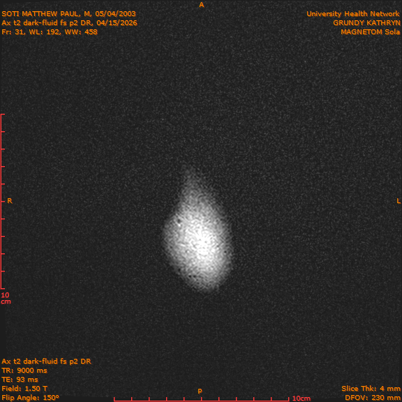 2026-04-15/Brain/Ax t2 dark-fluid fs p2 DR/0032-IM219.png