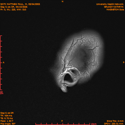 2026-04-15/Brain/Sag t1 se DR/0001-IM158.png