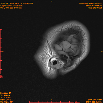 2026-04-15/Brain/Sag t1 se DR/0002-IM159.png