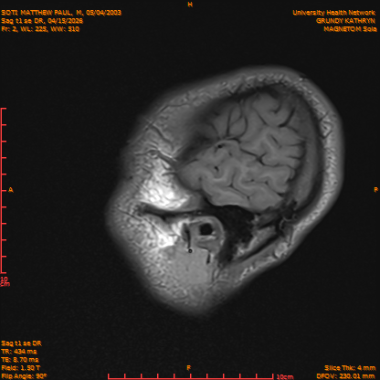 2026-04-15/Brain/Sag t1 se DR/0003-IM160.png