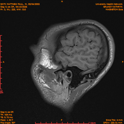 2026-04-15/Brain/Sag t1 se DR/0004-IM161.png