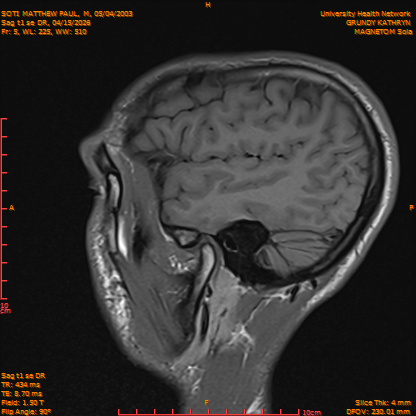 2026-04-15/Brain/Sag t1 se DR/0006-IM163.png