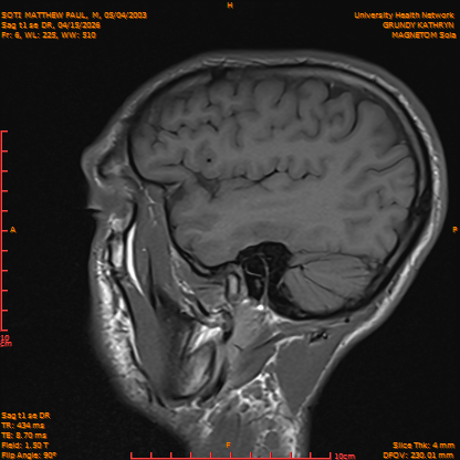 2026-04-15/Brain/Sag t1 se DR/0007-IM164.png