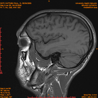 2026-04-15/Brain/Sag t1 se DR/0008-IM165.png