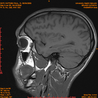 2026-04-15/Brain/Sag t1 se DR/0009-IM166.png