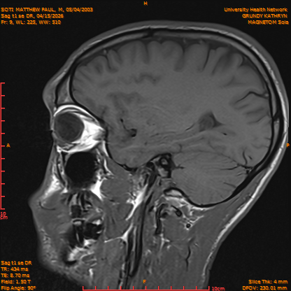 2026-04-15/Brain/Sag t1 se DR/0010-IM167.png