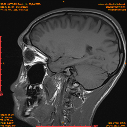 2026-04-15/Brain/Sag t1 se DR/0011-IM168.png