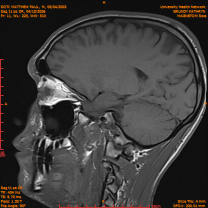 2026-04-15/Brain/Sag t1 se DR/0012-IM169.png