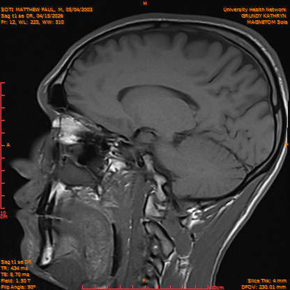 2026-04-15/Brain/Sag t1 se DR/0013-IM170.png