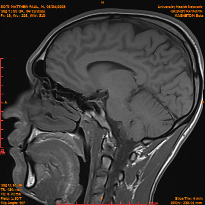 2026-04-15/Brain/Sag t1 se DR/0014-IM171.png