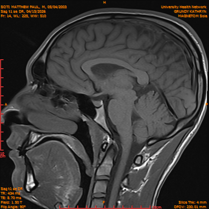 2026-04-15/Brain/Sag t1 se DR/0015-IM172.png