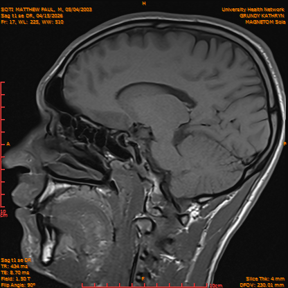 2026-04-15/Brain/Sag t1 se DR/0018-IM175.png
