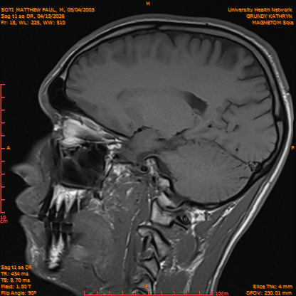 2026-04-15/Brain/Sag t1 se DR/0019-IM176.png