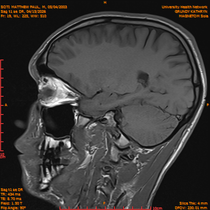 2026-04-15/Brain/Sag t1 se DR/0020-IM177.png