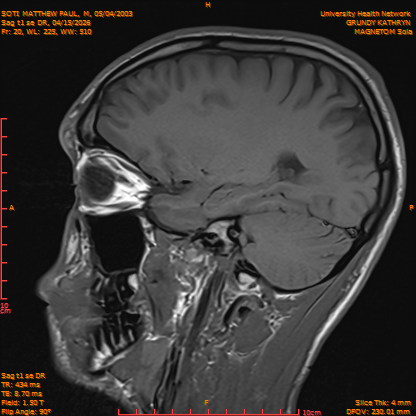2026-04-15/Brain/Sag t1 se DR/0021-IM178.png
